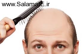 hair-loss (1)