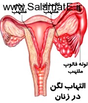  – بارداری: یک سری از عفونت های رحمی به دلیل بارداری رخ می دهند، زیرا بافت رحم، طی بارداری ملتهب و متورم می شود و بعد از زایمان، این عفونت ها رخ می دهند.