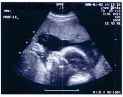 آیا سونوگرافی در دوران بارداری الزامی دارد ؟