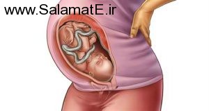 خانم‌ های باردار روز آخر بارداری باید چه اقداماتی انجام دهند؟
