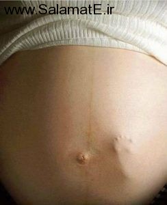 نکاتی بسیار مهم در مورد لگد زدن جنین بدانید