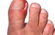 اگر از فرو رفتن ناخن پا در گوشت رنج می برید به این مطالب توجه کنید