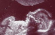 حداکثر تعداد سونوگرافی در دوران بارداری چقدر می باشد